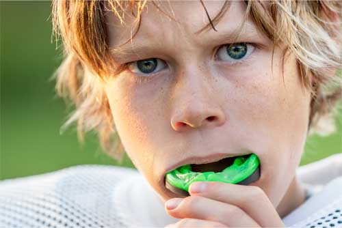 Sports Mouthguards